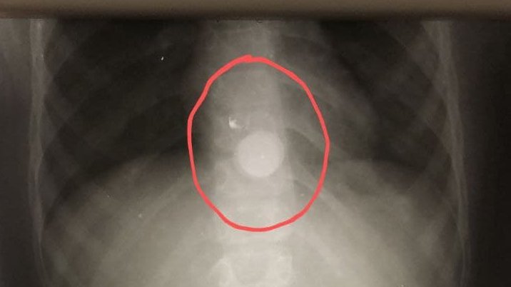 пресс-служба Министерства здравоохранения МО