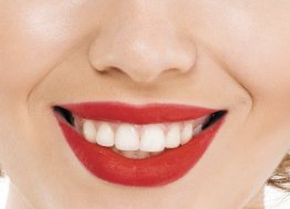 Секреты популярности зубных коронок из диоксида циркония – что за современная технология