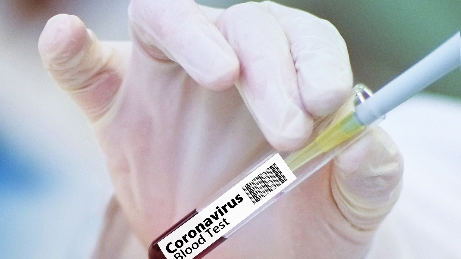 В России зарегистрировали еще два препарата для лечения коронавирусной инфекции