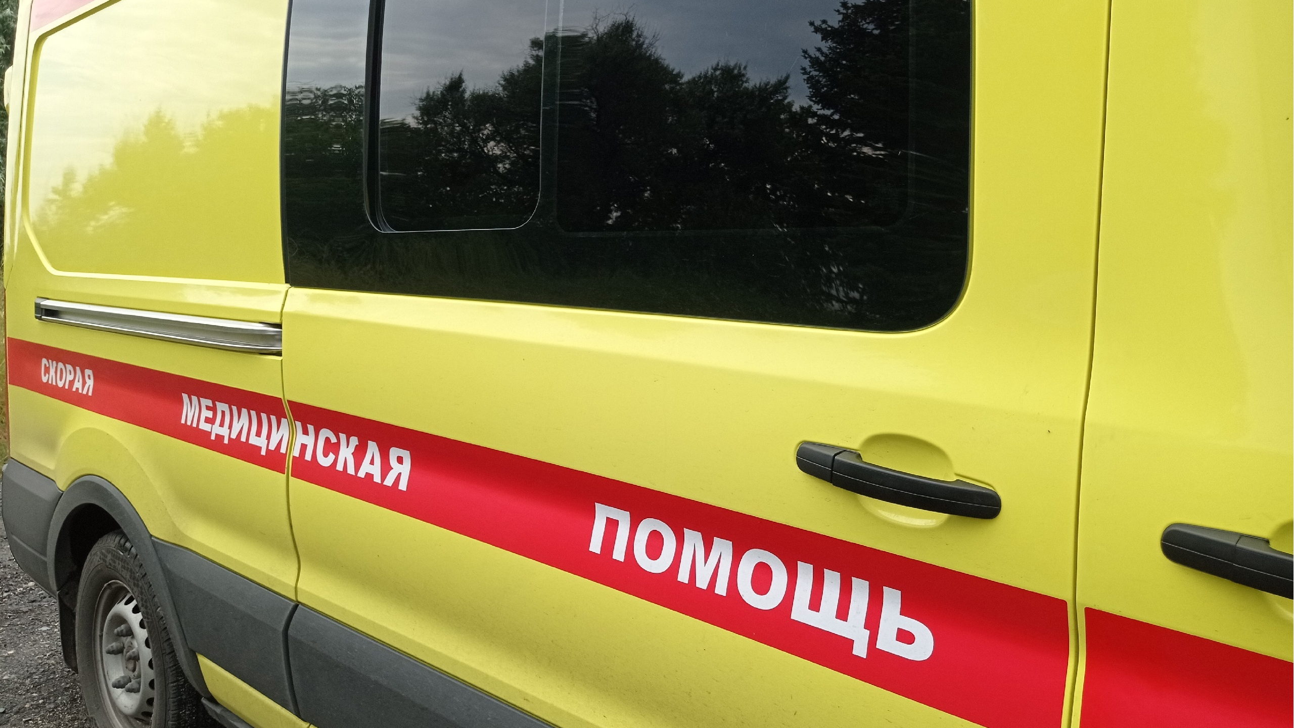 В Ульяновской области молодой мужчина получил сильные увечья при пожаре